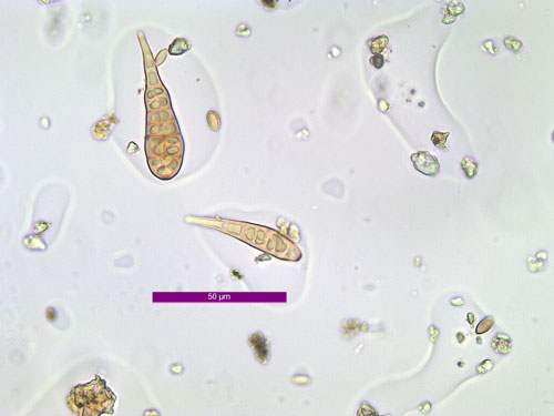 Alternaria